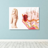 Illustratie van een atypische groei van de huid canvas afdruk (Insitu (Houten vloer))