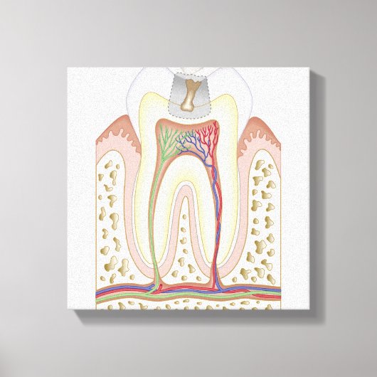 Illustratie van het Tooth Decay Canvas Afdruk (Voorkant)