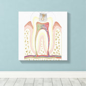 Illustratie van het Tooth Decay Canvas Afdruk (Insitu (Houten vloer))