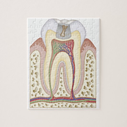 Illustratie van het Tooth Decay Legpuzzel (Verticaal)