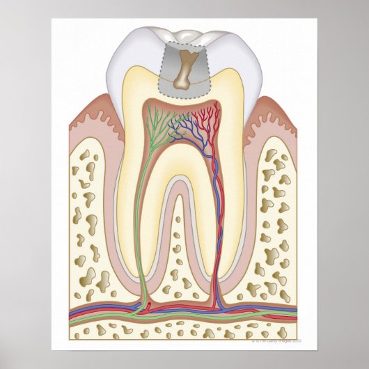 Illustratie van het Tooth Decay Poster (Voorkant)