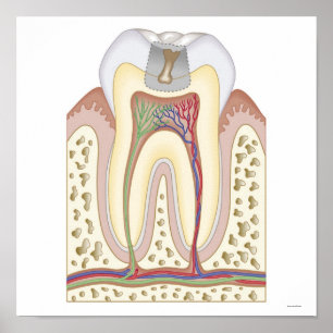 Illustratie van het Tooth Decay Poster