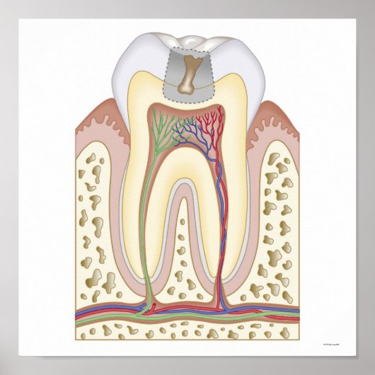 Illustratie van het Tooth Decay Poster (Voorkant)