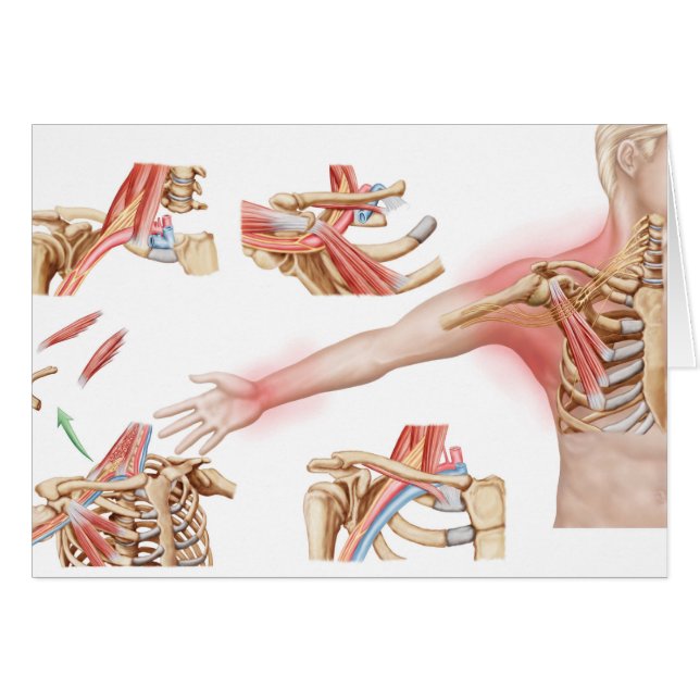 Illustration Médicale Détail de la sortie thoraciq (Devant horizontal)