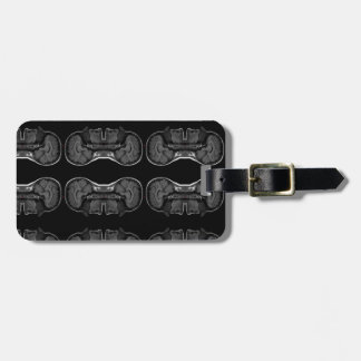 IM in uw hoofd röntgenfoto MRI scan medisch Bagagelabel