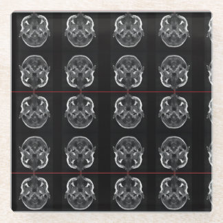 IM in uw hoofd röntgenfoto MRI scan medisch Glazen Onderzetter