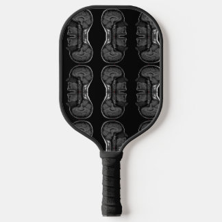 IM in uw hoofd röntgenfoto MRI scan medisch Pickleball Paddle
