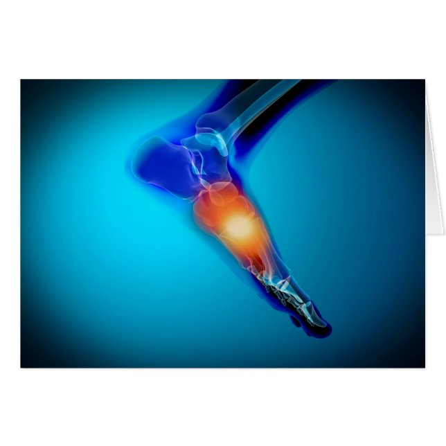 Image Conceptuelle De La Douleur Dans Le Pied Huma (Devant horizontal)