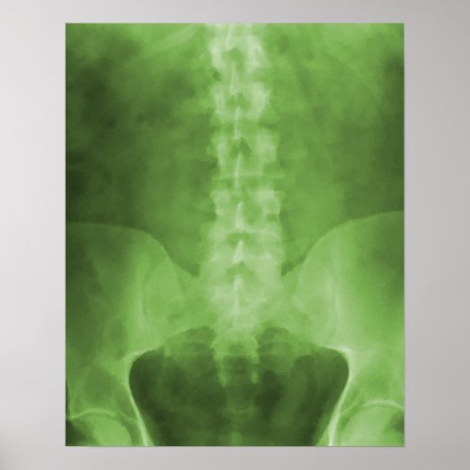 Impression d'art numérique en X-Ray vert (Devant)
