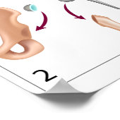 Impression de chirurgie de remplacement de la hanc (Coin)