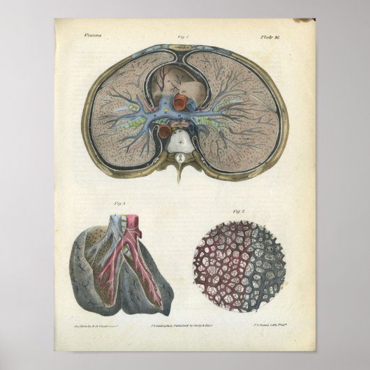 Impression de l'anatomie Vintage Bronchi pulmonair (Devant)