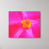 Impression de toile étirée (Recto)