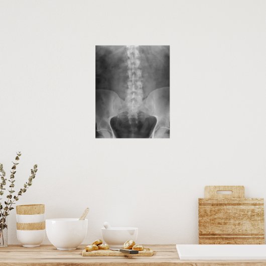 Impression numérique d'art X-Ray (Cuisine)