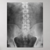Impression numérique d'art X-Ray (Devant)