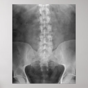 Impression numérique d'art X-Ray