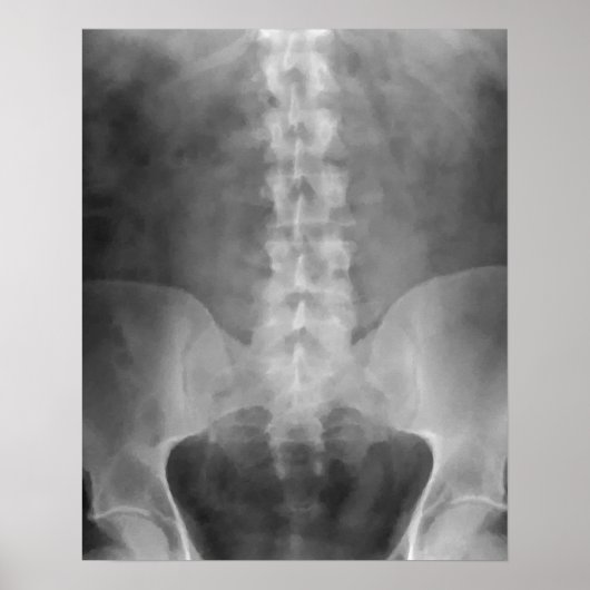 Impression numérique d'art X-Ray (Devant)
