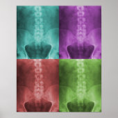 Impression numérique d'art X-Ray (Devant)