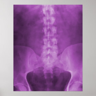 Impression numérique en rayons X violets