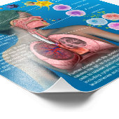 Impression Photo Allergies : affiche de réponse inflammatoire IgE (Coin)