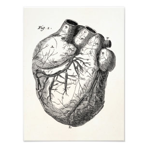 Impression Photo Coeurs cardiaques rétro Cardiac des années 1800 vi