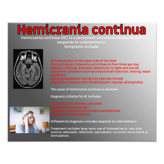 Impression Photo Hemicrania continua