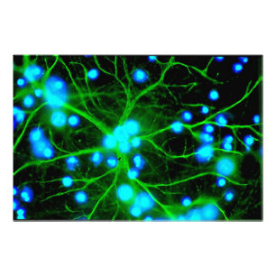 Impression Photo L'astrocyte sont les cellules de Glial en forme