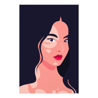 Impression Photo Portrait de femme asiatique Vitiligo Beauté Vector