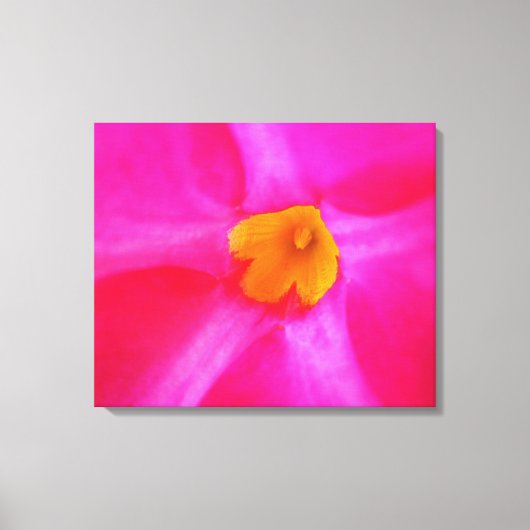Impression sur toile tendue (Recto)