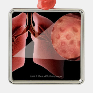 Inflammen van de luchtwegen tijdens een astmaaanva metalen ornament