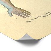 Innervatie van de huidzenuw van de menselijke arm  poster (Hoek)