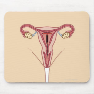 Intrauteriene inrichting muismat