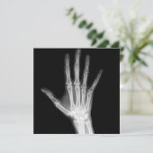 Invitation Bras squelettiques noir et blanc de rayon X (Debout devant)