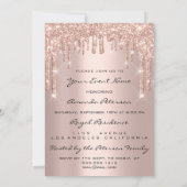 Invitation Fête d'anniversaire 16e Rose des lèvres Kiss Parti (Dos)