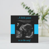 Invitation Garçon Baby Customisé Modèle photo Ultrasound (Debout devant)