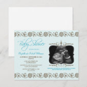 Invitation précieuse de baby shower de sonogramme (Devant / Derrière)