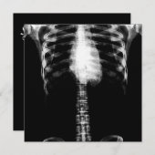 INVITATION RIBS DE TORSE DE SQUELETON X-RAY - B&W (Devant / Derrière)