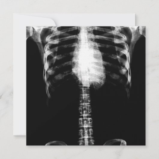 INVITATION RIBS DE TORSE DE SQUELETON X-RAY - B&W (Devant)