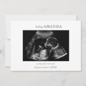 Invitation Taupe Muted Gray Ultrasound Photo Pregnancy Card (Dos)