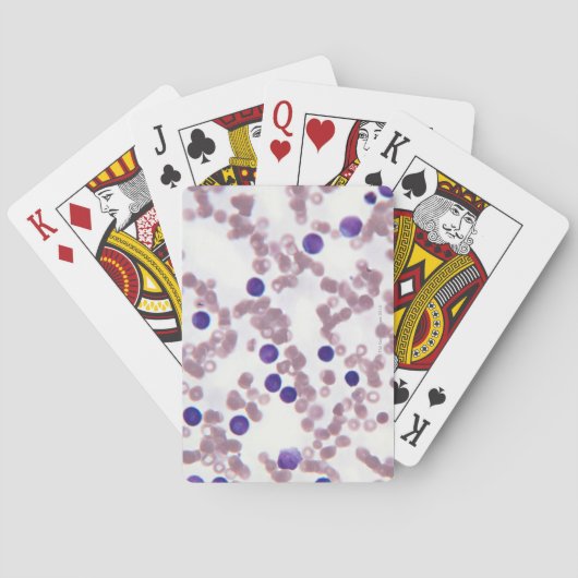Jeu De Cartes Cellules Lymphocytaires Néoplastiques (dos)