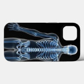 John Doe X-ray iPhone / coque ipad (Verso (horizontal))