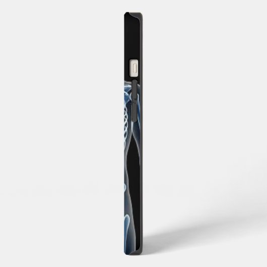 John Doe X-ray iPhone Hoesje (Linkerkant)