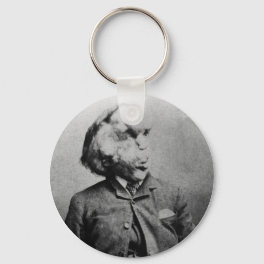 Joseph "John" Merrick The Elephant Man uit 1889 Sleutelhanger (Voorkant)