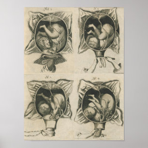 Justine Siegemund Court Verloskundige Zwangerschap Poster