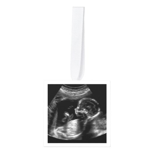 Kerst Zwangerschap Aankondiging Ultrasound Foto Kubus Ornament (Voorkant)