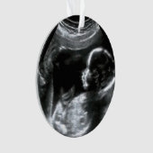 kerstBaby Sonogram Afbeelding Gift Ornament (voorkant)