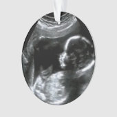 kerstBaby Sonogram Afbeelding Gift Ornament (voorkant)