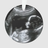 kerstBaby Sonogram Afbeelding Gift Ornament (voorkant)