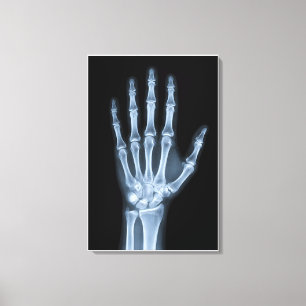 Klinische Röntgenfoto van een hand Canvas Afdruk
