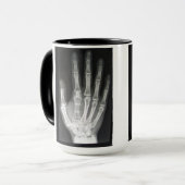 Koningin in de hand-röntgenfoto mok (Voorkant links)