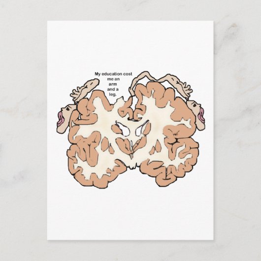 Kost een arm en een beenhomunculus briefkaart (Voorkant)